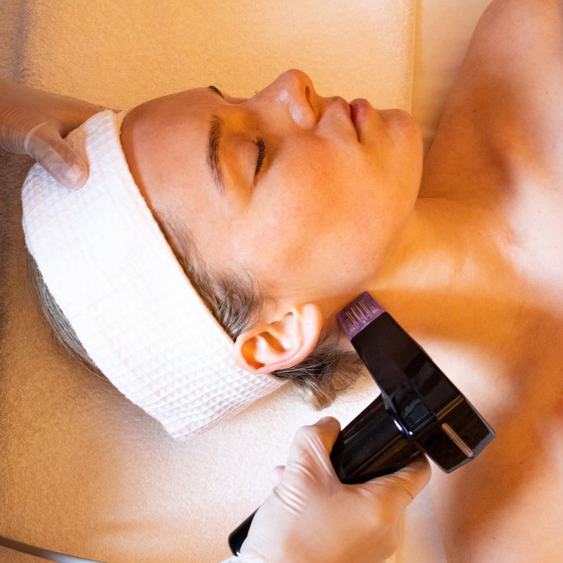 OUR RF MICRONEEDELING Q&A