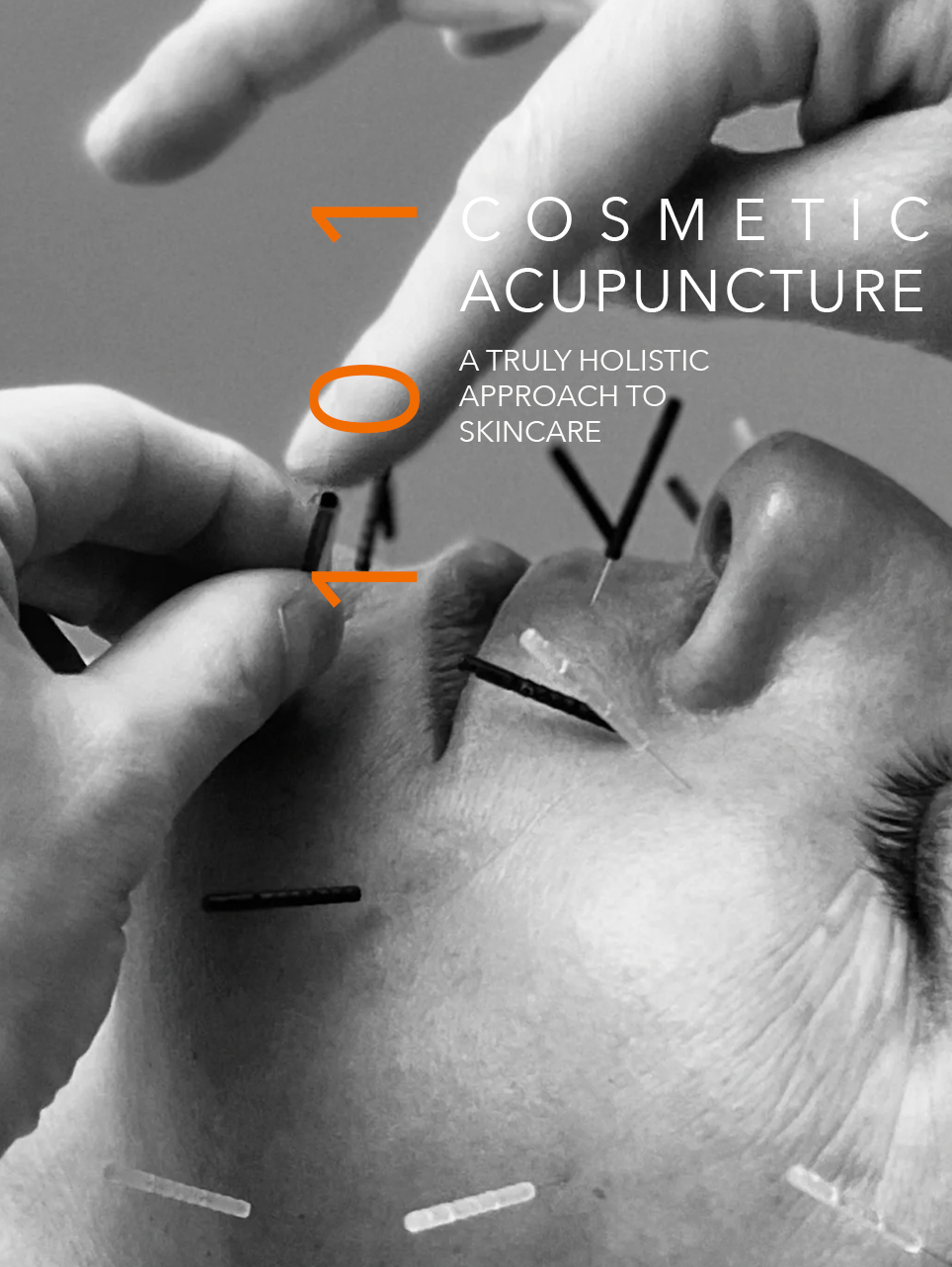 COSMETIC ACUPUNCTURE