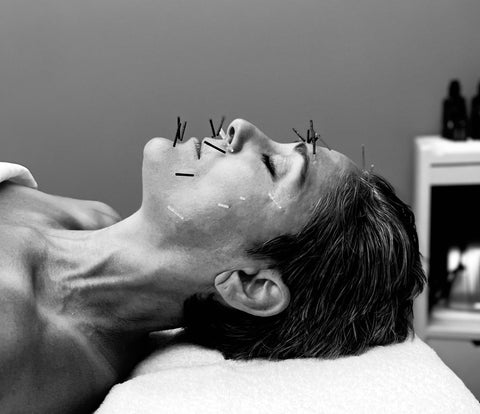 MERIDIAN ACUPUNCTURE FACIAL TUNE-UP