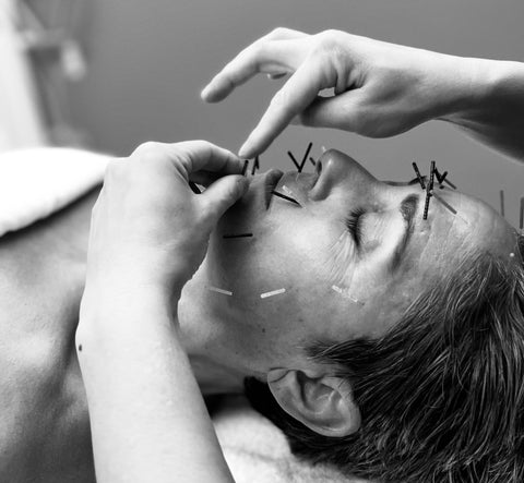 MERIDIAN ACUPUNCTURE FACIAL TUNE-UP